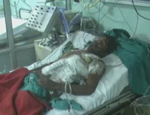 PGI Rohtak 300x231 Doctors save life of a man pierced by iron rods