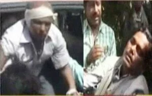 TMC CHooped off Panchayat member Ear feb21 300x190 TMC’s Goondaraj: Party activists chop off Panchanyat employee’s ear